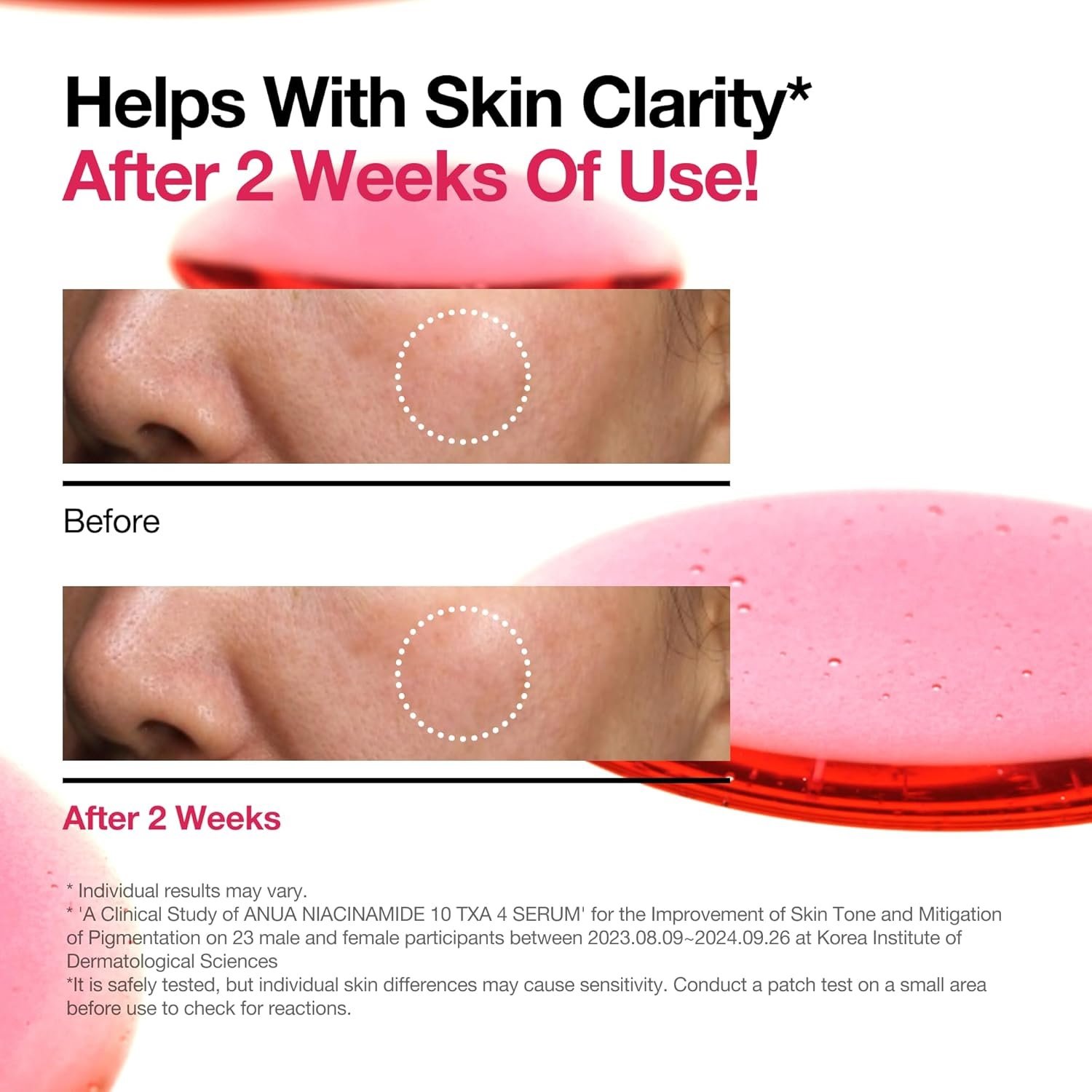 nia10serum3 nia10serum3